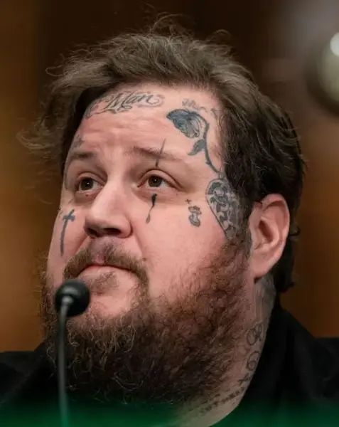 Allan Kayser Net Worth